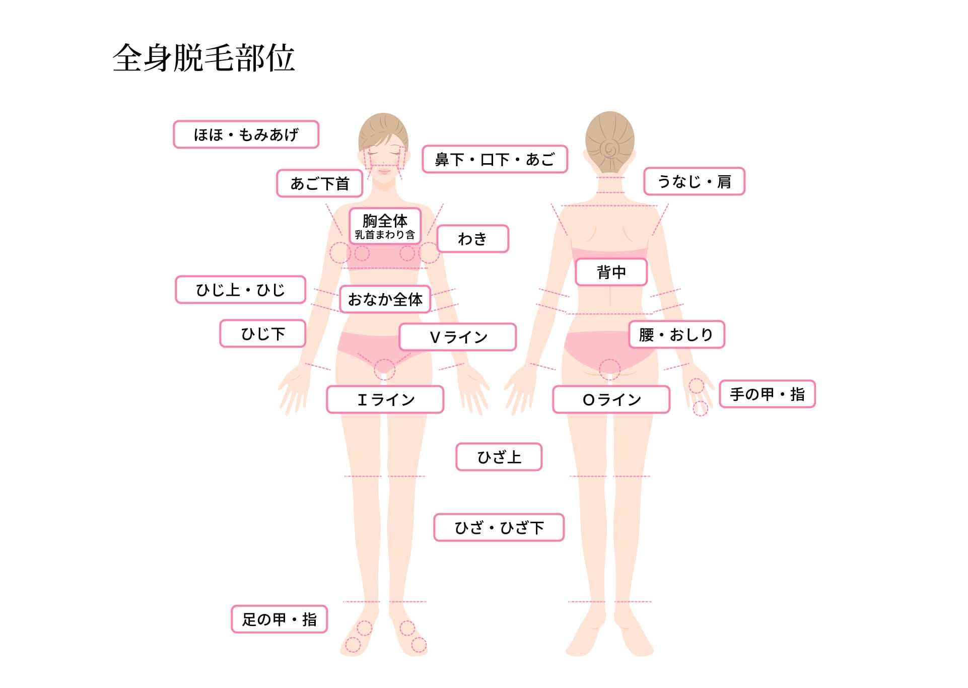 全身脱毛部位