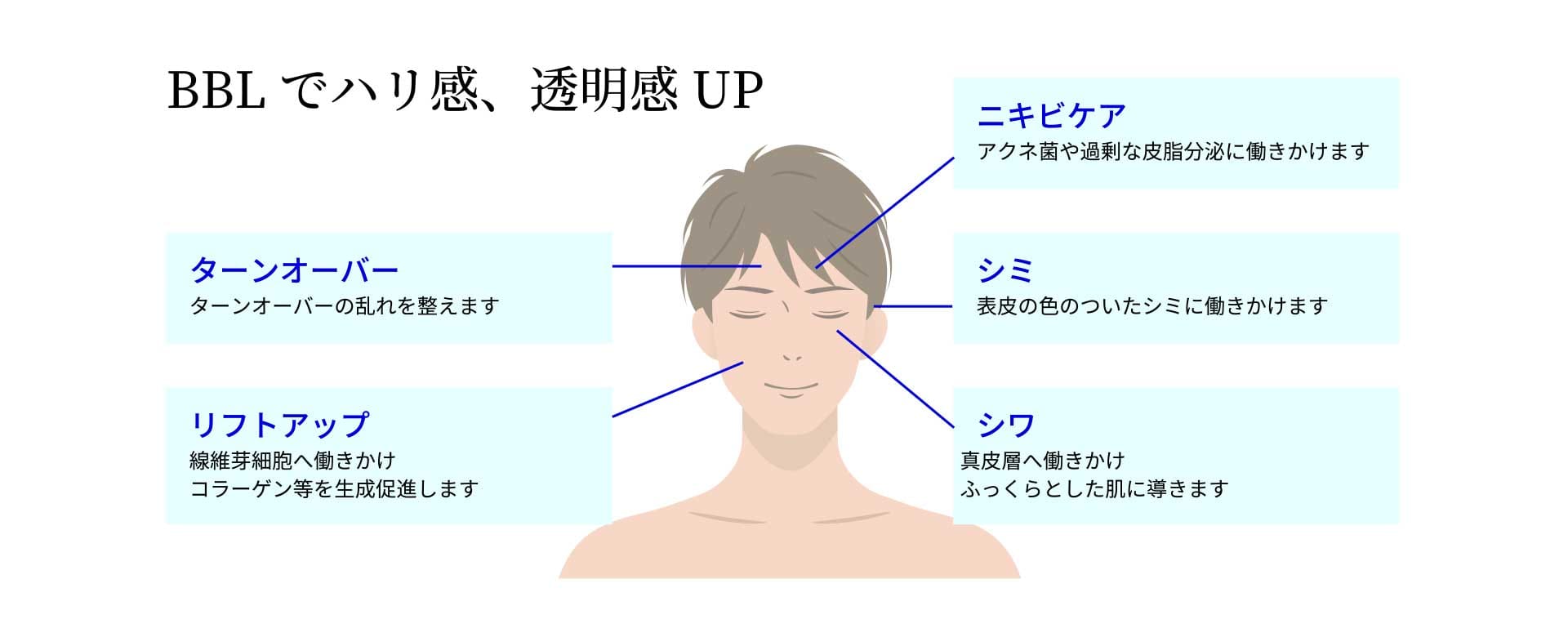 BBLでハリ感、透明感UP｜ターンオーバー・ニキビケア・シミ・リフトアップ・シワ