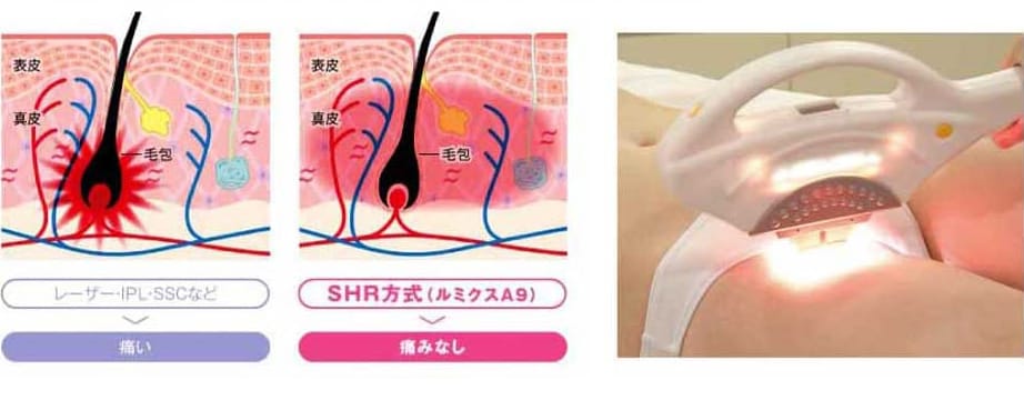 SHR方式（ルミクスA9）の図